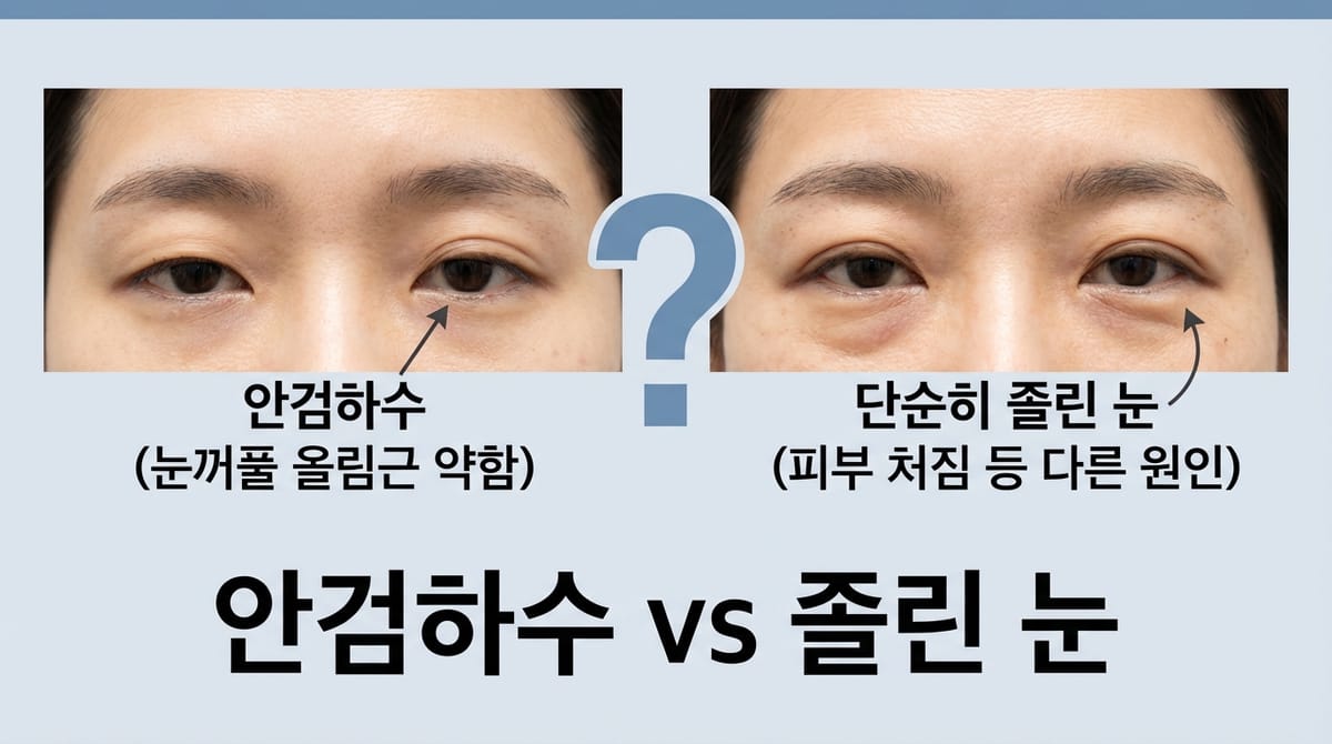 안검하수와 눈매교정 — 모든 졸린 눈에 눈매교정이 필요할까요?