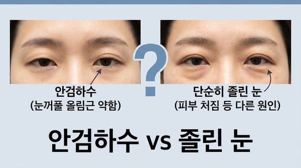 안검하수와 눈매교정 — 모든 졸린 눈에 눈매교정이 필요할까요?