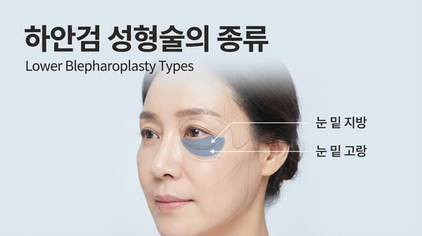 성형수술 용어 바르게 알기 - 하안검 성형술