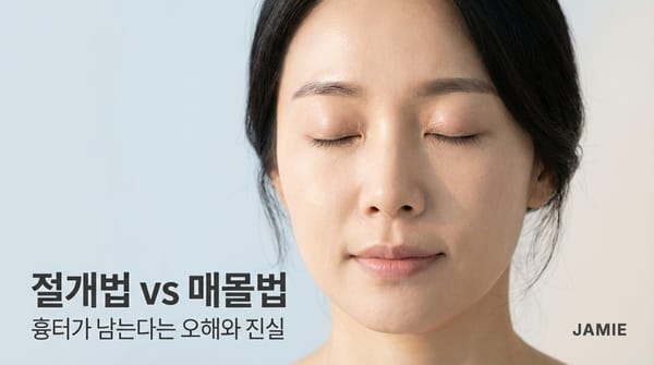 절개법 vs 매몰법 — 흉터가 남는다는 오해와 진실